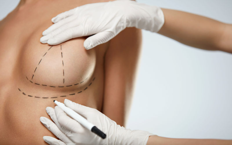 Chirurgie esthétique des seins